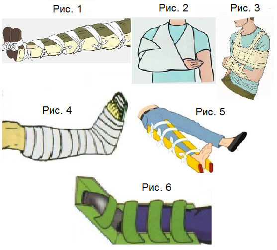 Подручные средства транспортной иммобилизации. Транспортная шина. Шины для транспортной иммобилизации. Иммобилизация с помощью подручных средств. Средства иммобилизации аутоиммобилизация.